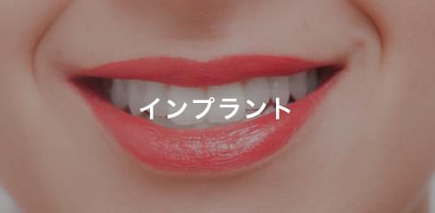 インプラント