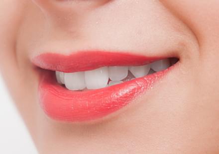 ガムピーリングの費用